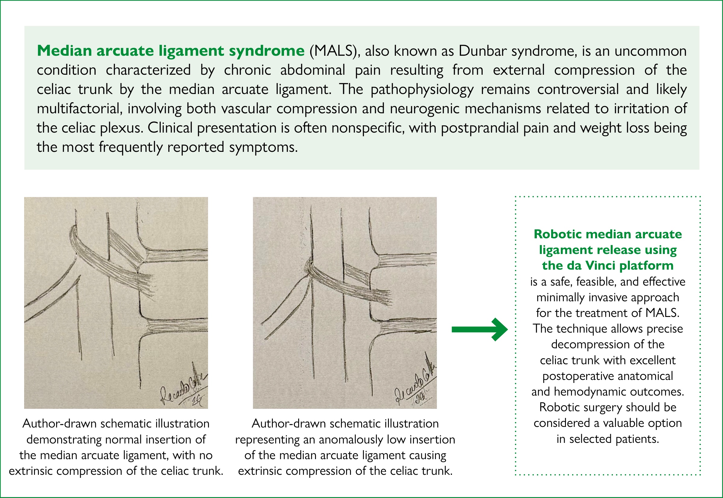 Visual abstract