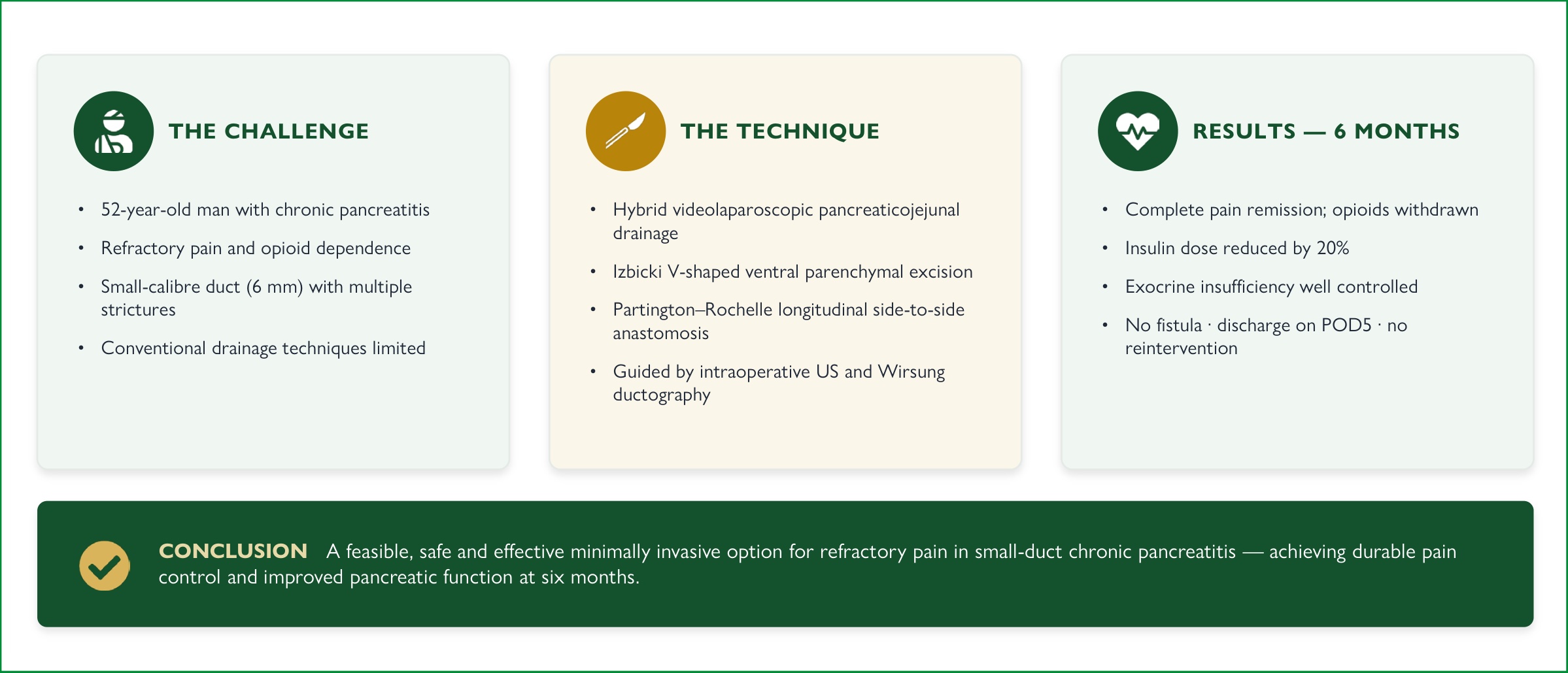 Videolaparoscopic pancreatojejunostomy using a hybrid technique in chronic pancreatitis without significant ductal dilatation 1 Visual abstract